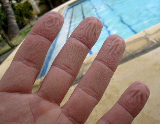 Физики объяснили морщинки на мокрых пальцах