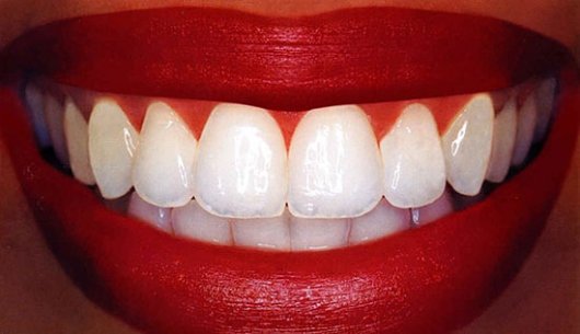15 интересных фактов о зубах
