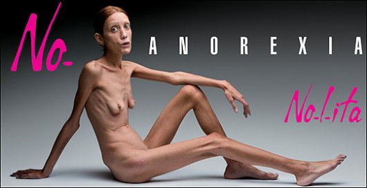 Анорексия фото